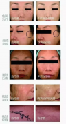 超皮秒公司_超皮秒儀器供應(yīng)商_超皮秒是亞皮秒嗎？