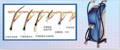 廣州脫毛儀器價(jià)格，脫毛一次多少錢(qián)，用什么儀器比較好？