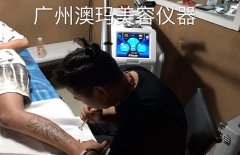 美國(guó)蜂巢皮秒多少價(jià)位?洗紋身機(jī)器什么牌子_一臺(tái)洗紋身機(jī)多少錢(qián)