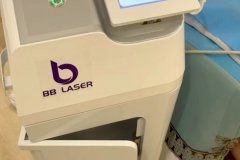 BB laser素顏光國內(nèi)哪個生產(chǎn)廠家比較好？進(jìn)口素顏光設(shè)備代理商